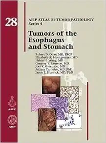 Tumors of the Esophagus and Stomach (AFIP Atlas of Tumor Pathology, Series 4, 28) (Original PDF from Publisher)