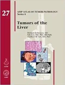 Tumors of the Liver (AFIP Atlas of Tumor Pathology, Series 4, Fascicle 27) (Original PDF from Publisher)