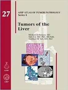 Tumors of the Liver (AFIP Atlas of Tumor Pathology, Series 4, Fascicle 27)