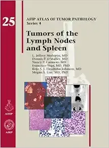 Tumors of the Lymph Nodes and Spleen