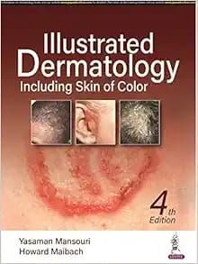Illustrated Dermatology, 4th Edition