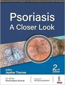 Psoriasis: A Closer Look, 2nd Edition