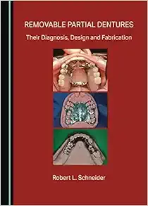 Removable Partial Dentures: Their Diagnosis, Design and Fabrication (Original PDF from Publisher)