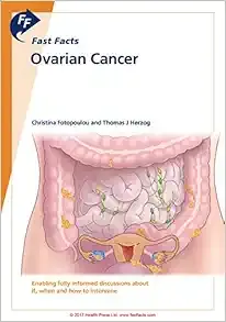 Fast Facts: Ovarian Cancer