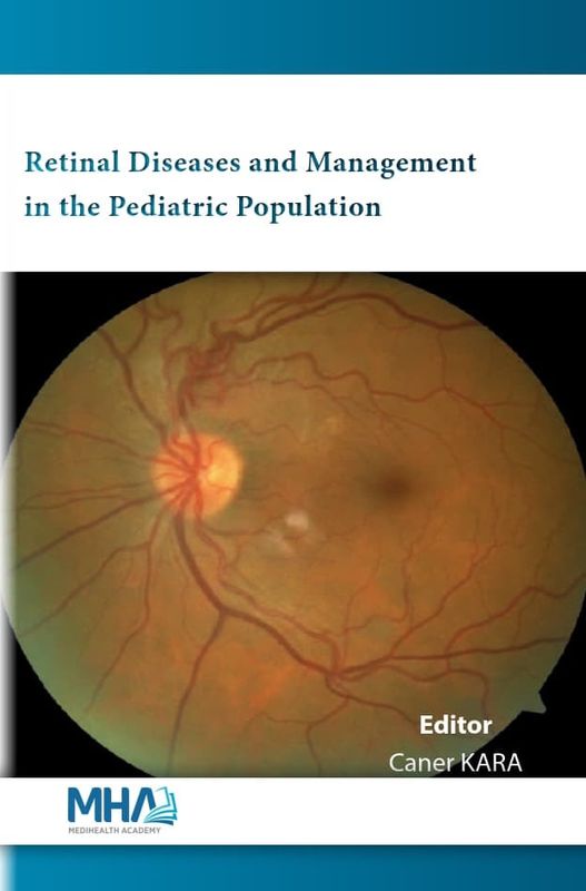 Retinal Diseases and Management in the Pediatric Population (Original PDF from Publisher)