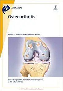 Fast Facts: Osteoarthritis, 3rd Edition (Original PDF from Publisher)
