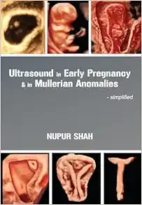 Ultrasound in Early Pregnancy &amp; in Mullerian Anomalies – Simplified