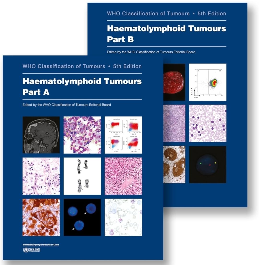 The WHO Classification of Tumours Haematolymphoid Tumours (Volume 11) 5th edition