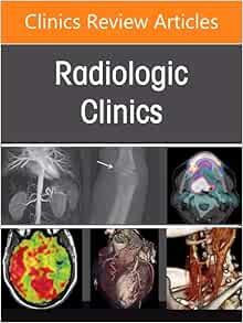 Pearls and Pitfalls in Thoracic Disease Imaging, An Issue of Radiologic Clinics of North America (Volume 63-4) (The Clinics: Radiology, Volume 63-4) (EPUB)