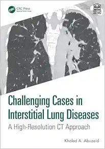 Challenging Cases in Interstitial Lung Diseases (Original PDF from Publisher) 2025