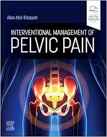 Interventional Management of Pelvic Pain