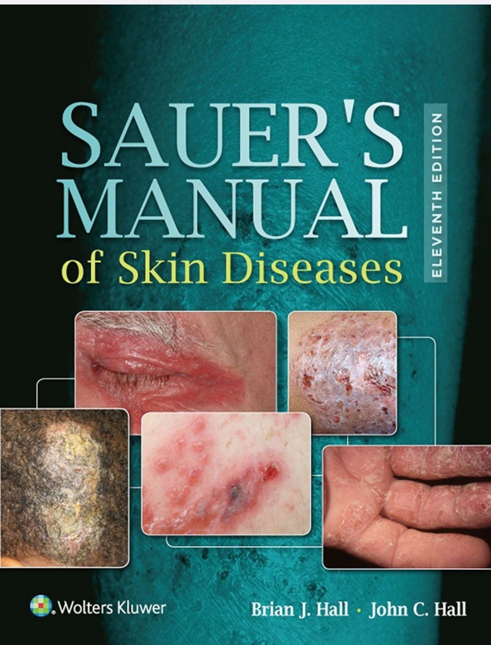 Sauer’s Manual Of Skin Diseases, 11th Edition