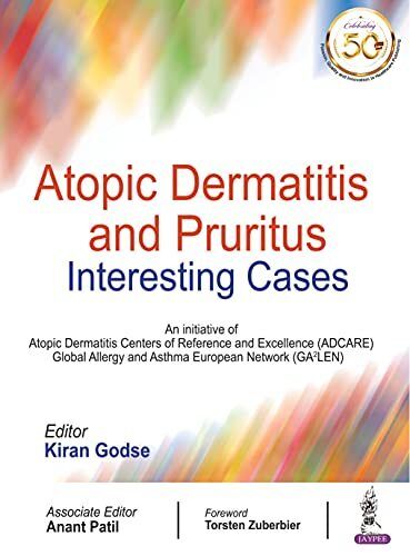 Atopic Dermatitis And Pruritus Interesting Cases