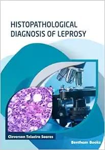 Histopathological Diagnosis Of Leprosy