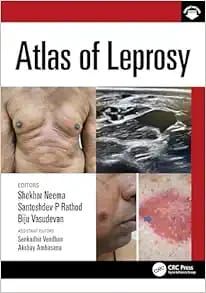 Atlas of Leprosy