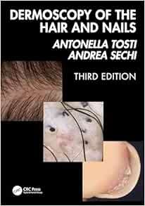 DERMOSCOPY OF THE HAIR AND NAILS, 3rd edition