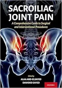 Sacroiliac Joint Pain: A Comprehensive Guide to Interventional and Surgical Procedures