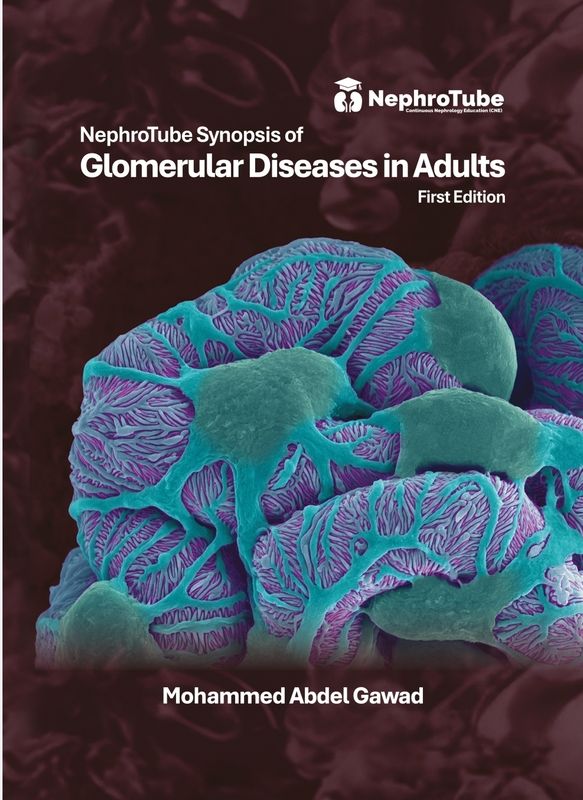 NephroTube Synopsis of Glomerular Diseases in Adults