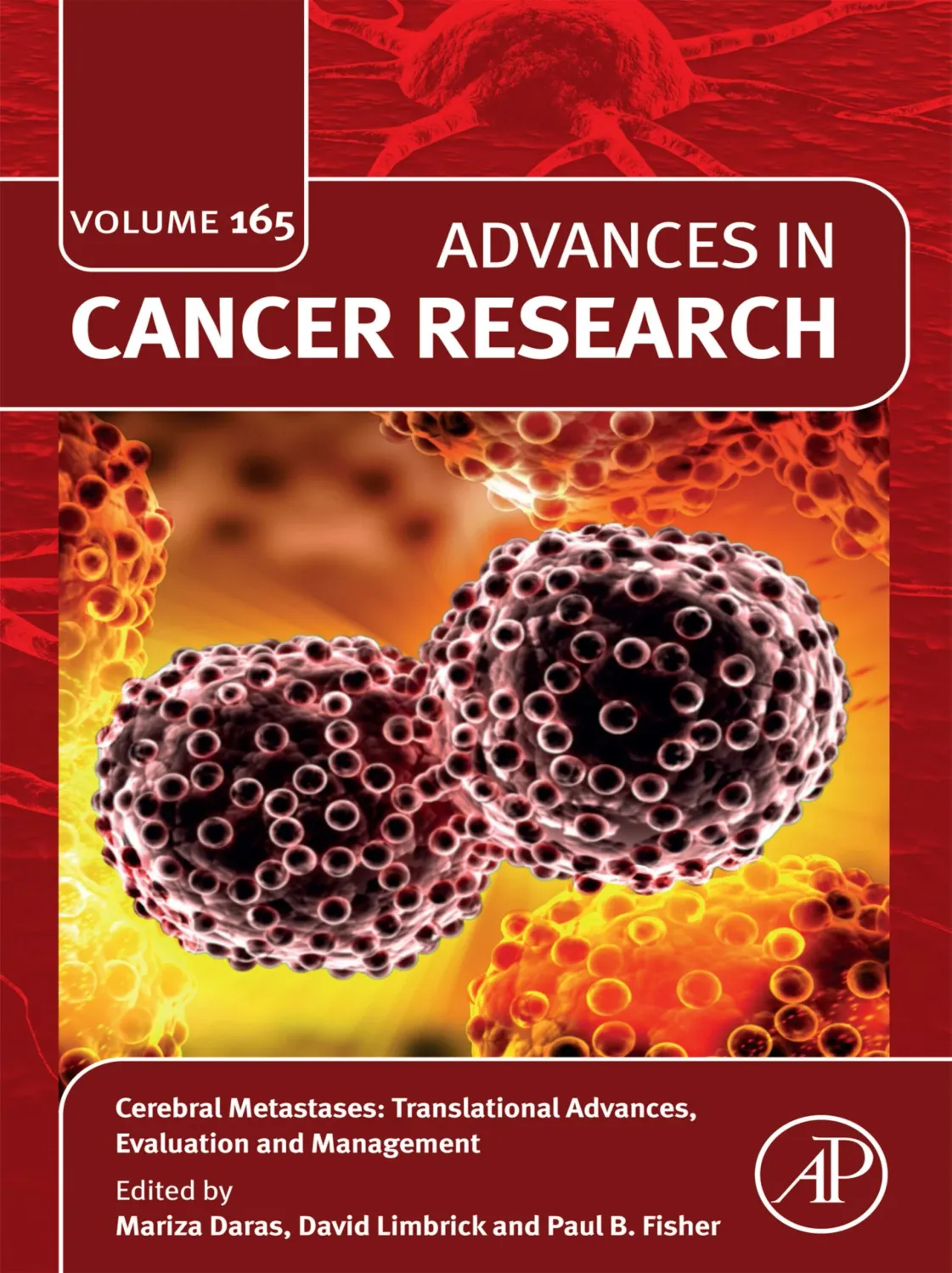 Cerebral Metastases: Translational Advances, Evaluation and Management (Original PDF from Publisher)