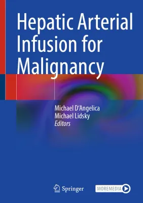 Hepatic Arterial Infusion for Malignancy (Original PDF from Publisher)