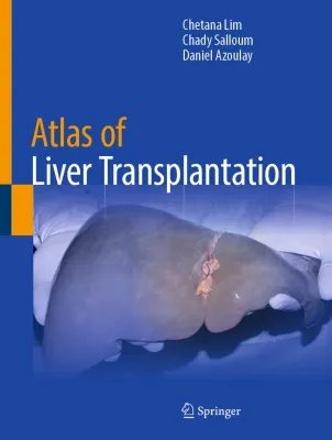 Atlas of Liver Transplantation (Original PDF from Publisher)