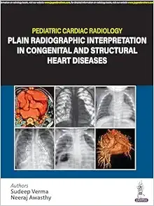 Pediatric Cardiac Radiology: Plain Radiographic Interpretation in Congenital and Structural Heart Diseases (Original PDF from Publisher)