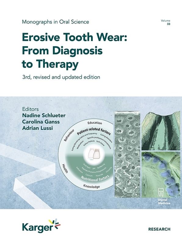 Erosive Tooth Wear: From Diagnosis to Therapy, 3rd Edition (Original PDF from Publisher)