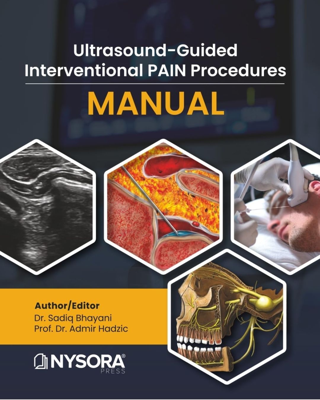 Ultrasound-Guided Interventional Pain Procedures Manual (EPUB+Converted PDF and Full HD Videos+4K Videos)