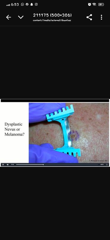 Primary Care On Demand: Dermatology