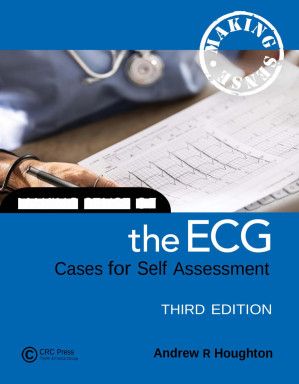 Making Sense of the ECG - Cases for Self Assessment, 3e