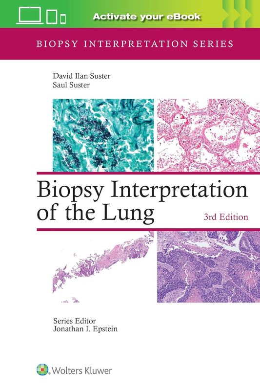 Biopsy Interpretation of the Lung (Biopsy Interpretation Series)