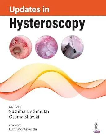 Updates in Hysteroscopy (Original PDF from Publisher