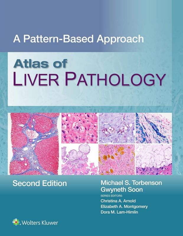 Atlas of Liver Pathology: A Pattern-Based Approach, 2nd Edition