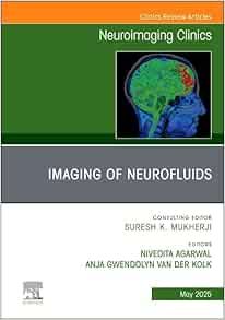 Imaging of Neurofluids, An Issue of Neuroimaging Clinics of North America (Volume 35-2) (The Clinics: Radiology, Volume 35-2) (True PDF from Publisher)