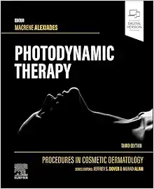 Procedures in Cosmetic Dermatology: Photodynamic Therapy, 3rd Edition