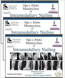 Tips &amp; Tricks Masterclass of Intramedullary Nailing, 3 Volumes Se