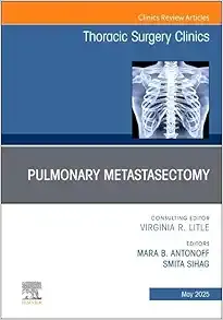 Pulmonary Metastasectomy, An Issue of Thoracic Surgery Clinics (Volume 35-2) (The Clinics: Internal Medicine, Volume 35-2)