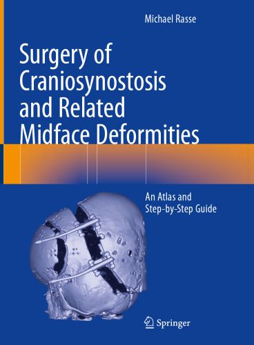 Surgery of Craniosynostosis and Related Midface Deformities: An Atlas and Step-by-Step Guide (English Edition)