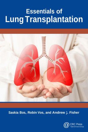 Essentials of Lung Transplantation (English Edition