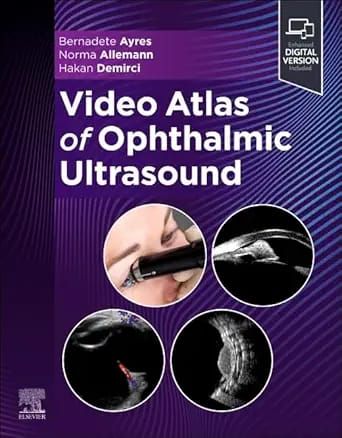 Video Atlas of Ophthalmic Ultrasound