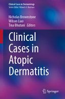Clinical Cases in Atopic Dermatitis (Clinical Cases in Dermatology)