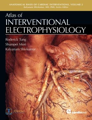 Atlas of Interventional Electrophysiology (Anatomical Basis of Cardiac Interventions, Band 2