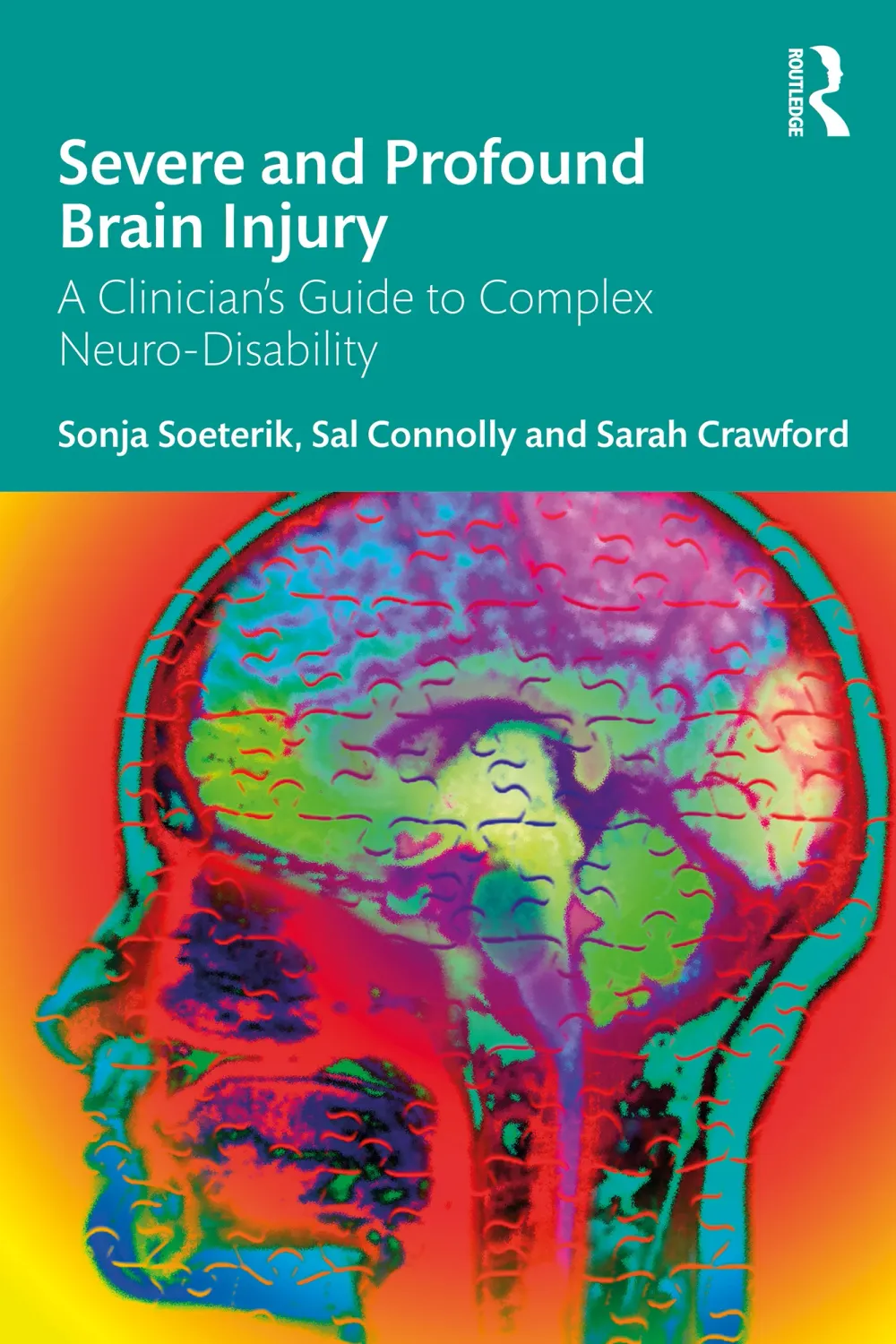 Severe and Profound Brain Injury: A Clinician’s Guide to Complex Neuro-Disability (Original PDF from Publisher)