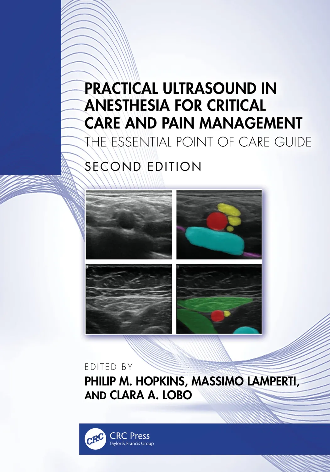 Practical Ultrasound in Anesthesia for Critical Care and Pain Management: The Essential Point of Care Guide, 2nd Edition (Original PDF from Publisher)