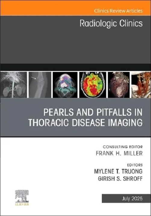 Pearls and Pitfalls in Thoracic Disease Imaging, An Issue of Radiologic Clinics of North America (Volume 63-4) (The Clinics: Radiology, Volume 63-4) (True PDF from Publisher)