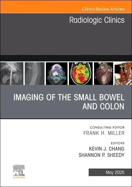 Imaging of the Small Bowel and Colon, An Issue of Radiologic Clinics of North America (Volume 63-3) (The Clinics: Radiology, Volume 63-3) (True PDF from Publisher)