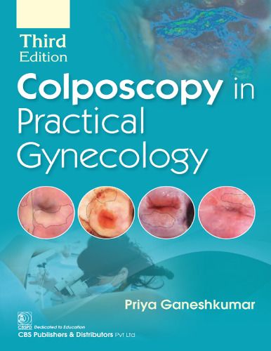 Colposcopy in Practical Gynecology, 3rd Edition