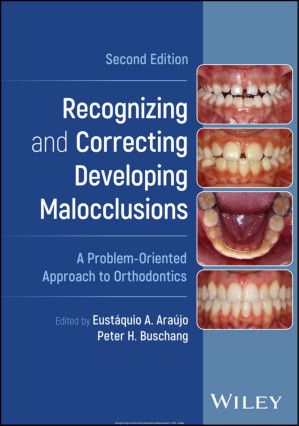 Recognizing and Correcting Developing Malocclusions: A Problem-Oriented Approach to Orthodontics, 2nd edition