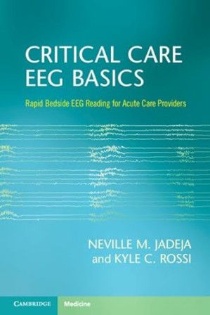 CRITICAL CARE EEG BASICS