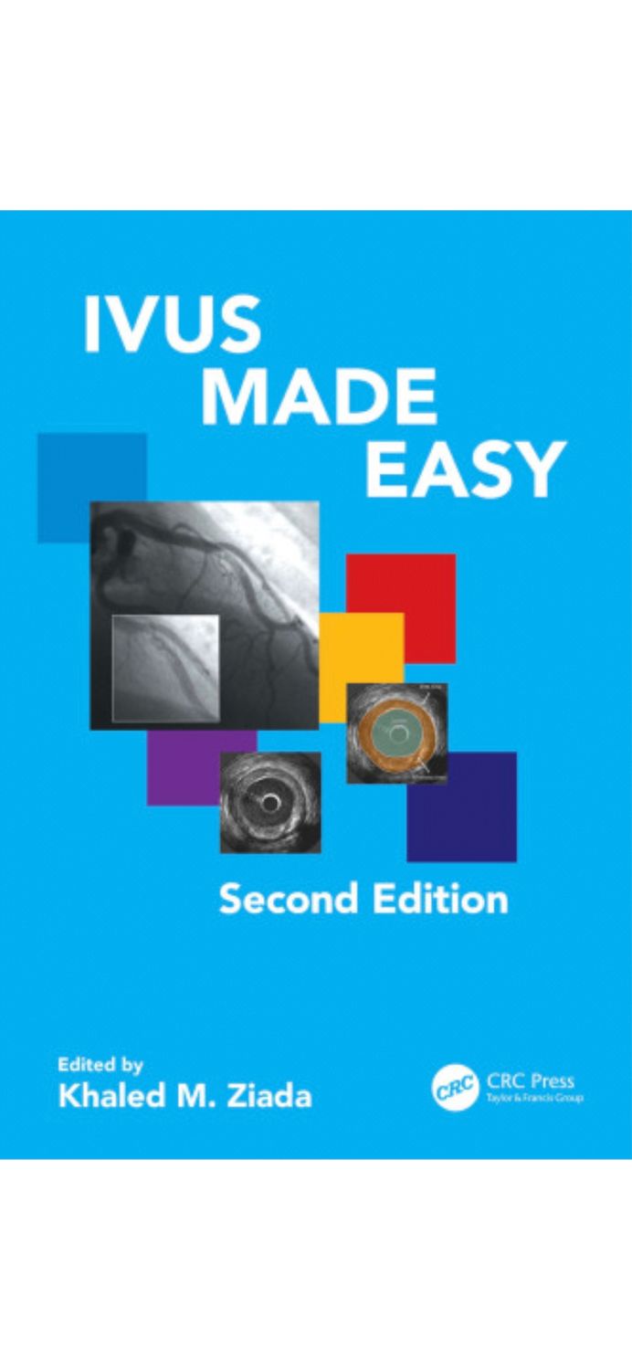 IVUS MADE EASY